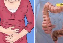 How to Get Rid of Constipation at Home: Fast and Effective Methods