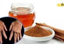 The mixture of cinnamon and honey can treat arthritis! Simple and effective.